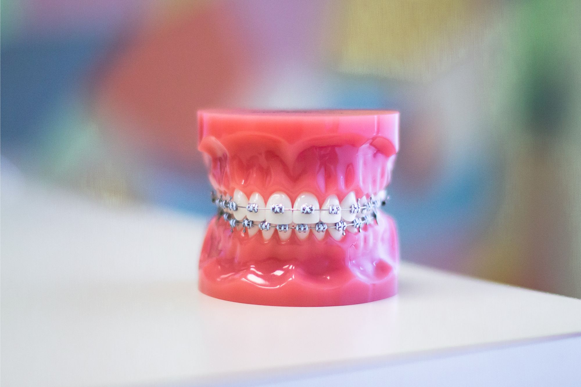 Metal Braces | Celina TX Braces | Hemphill Orthodontics