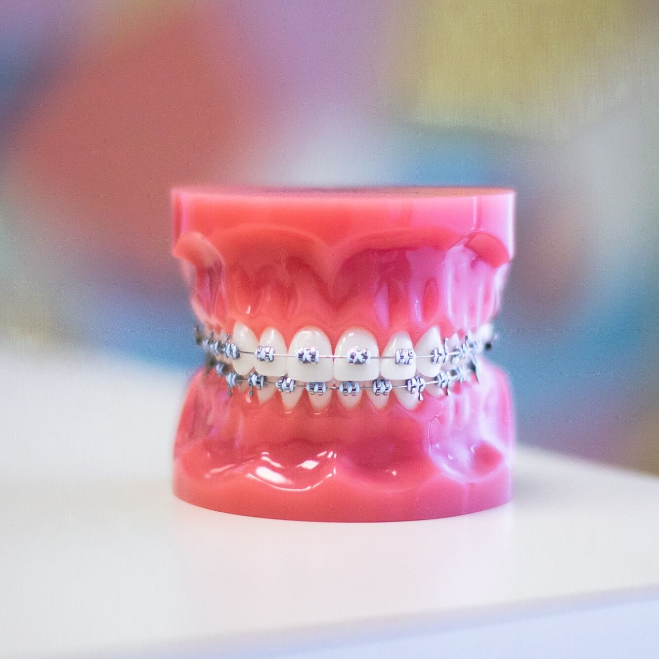 braces on model teeth